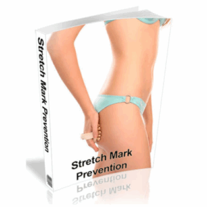 stretch-marks-prevention-and-treatment